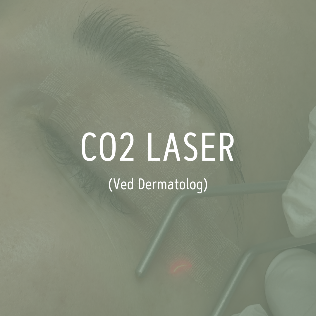 CO2 laser - Udføres af dermatolog
