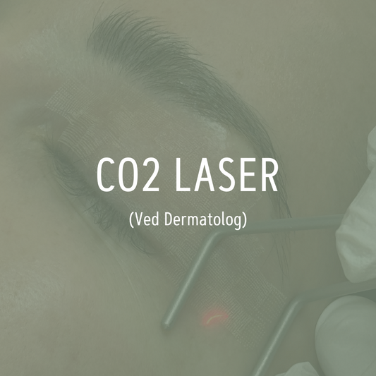 CO2 laser - Udføres af dermatolog