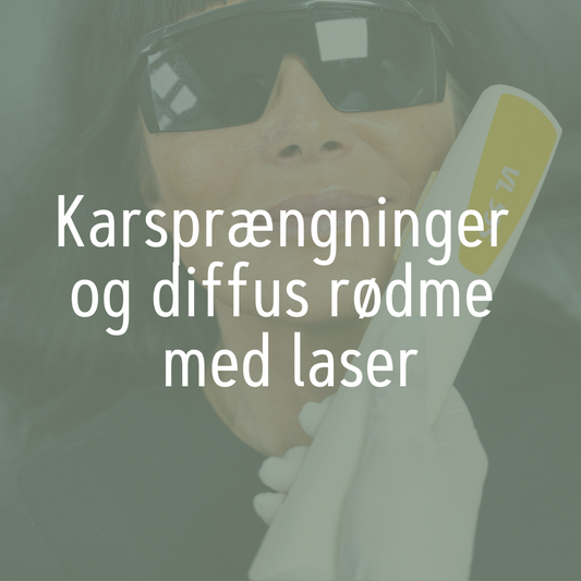 Karsprængninger og diffus rødme med laser
