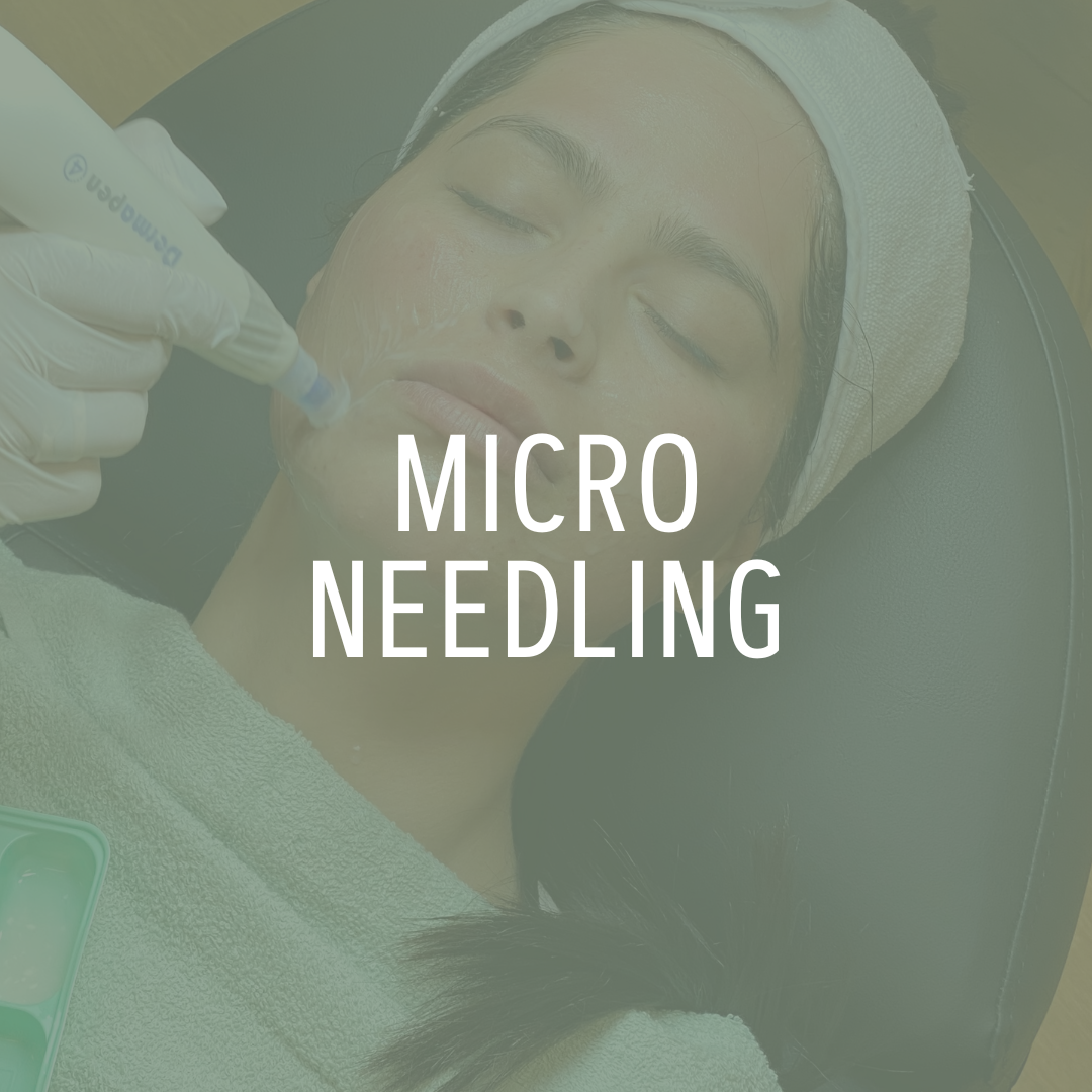 Medicinsk Micro Needling