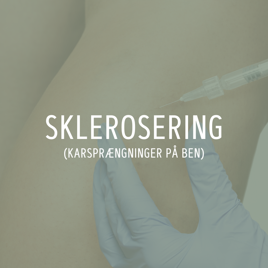 Sklerosering (Karsprængninger på ben)