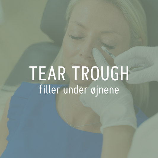 Tear trough - filler under øjnene