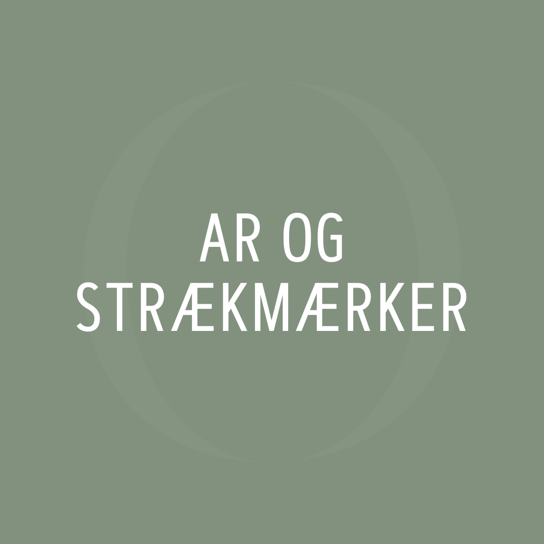 Ar og Strækmærker
