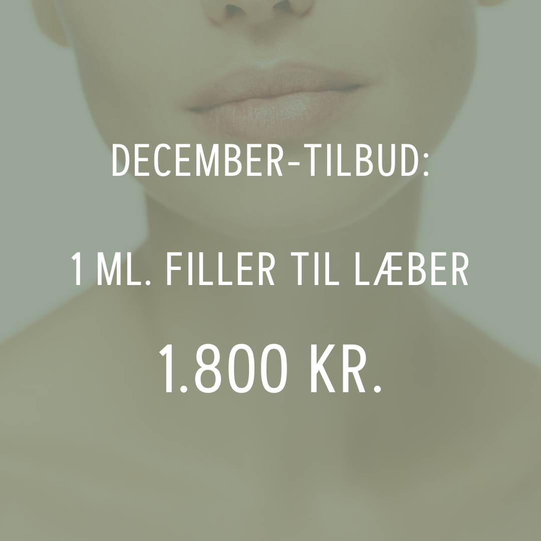 1 ml. filler til læber - 1.800 kr.