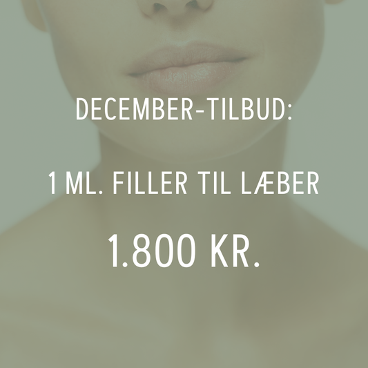 1 ml. filler til læber - 1.800 kr.